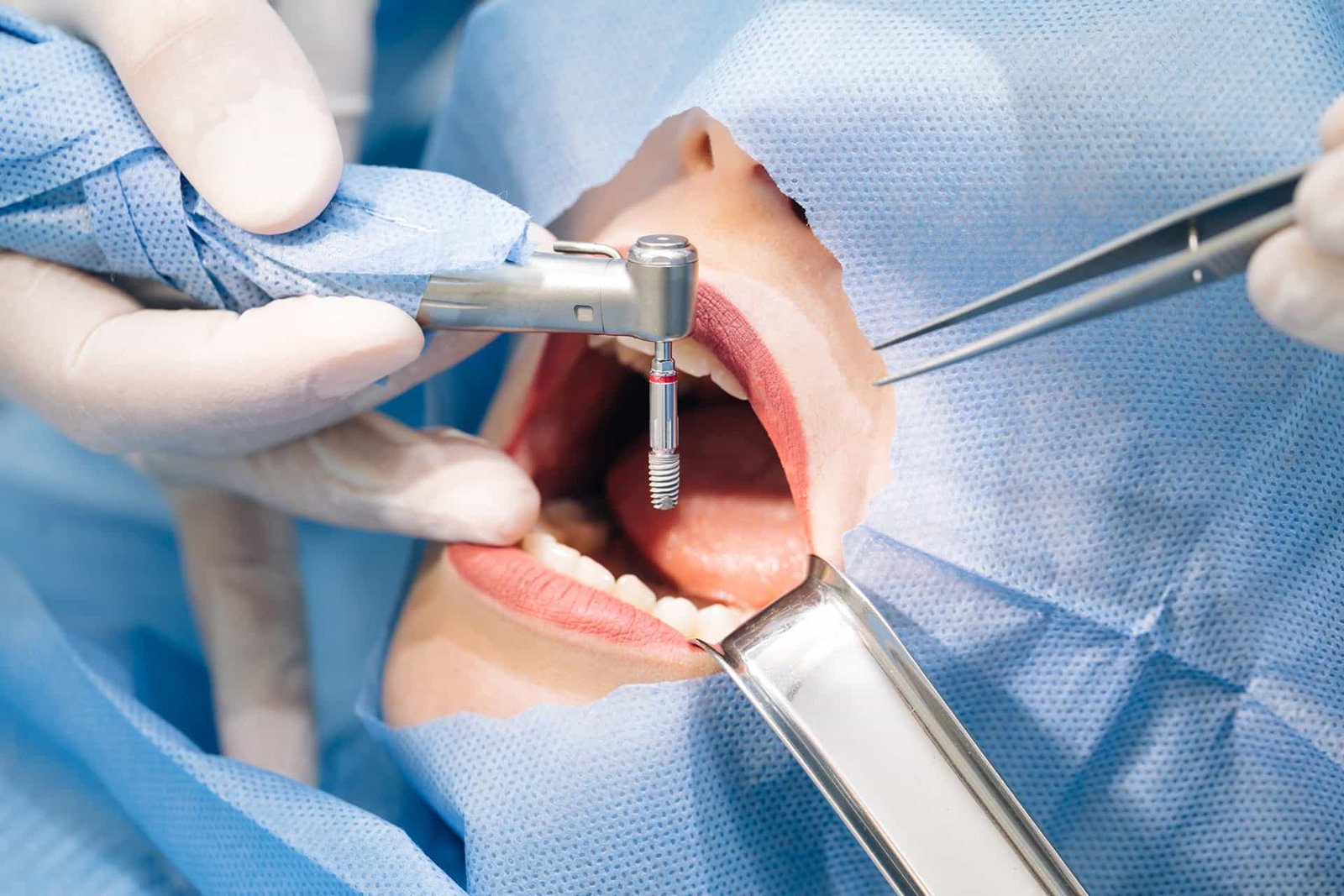 oral oral
